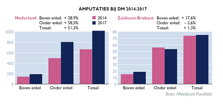 Betere diabeteszorg, minder amputaties